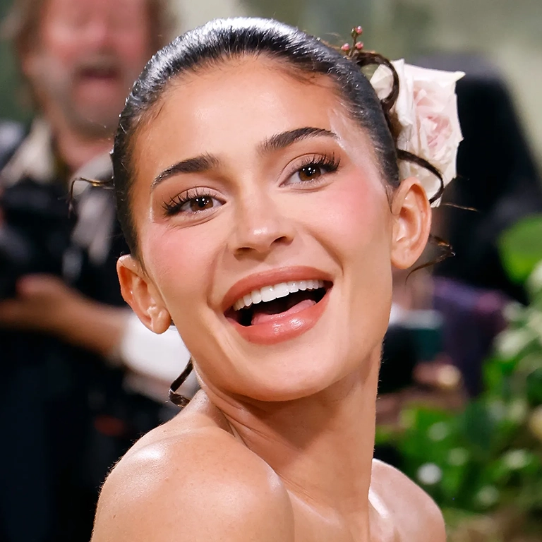 Kylie Jenner veneer transformation